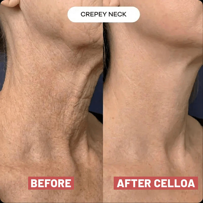 Nuvere Neck Patches