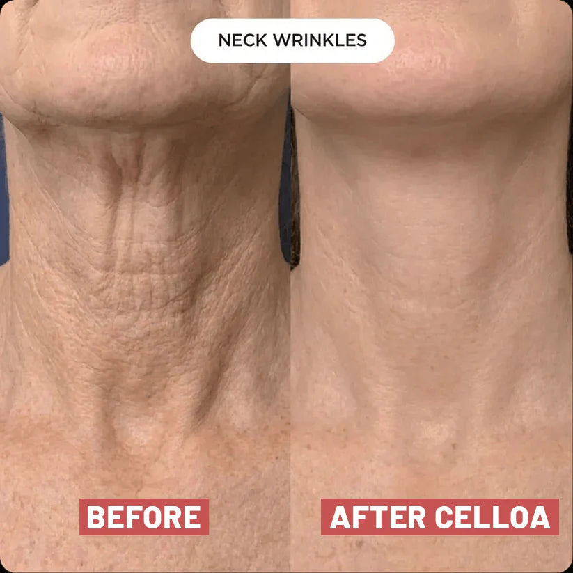 Nuvere Neck Patches