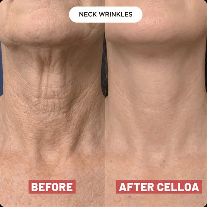 Nuvere Neck Patches